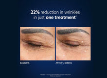 Load image into Gallery viewer, Hyaluronic Acid Microneedle Eye Patches