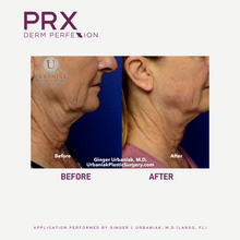 Load image into Gallery viewer, PRX Dermal Perfexion- In office treatment only