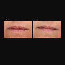 Load image into Gallery viewer, Overnight Lip Mask

